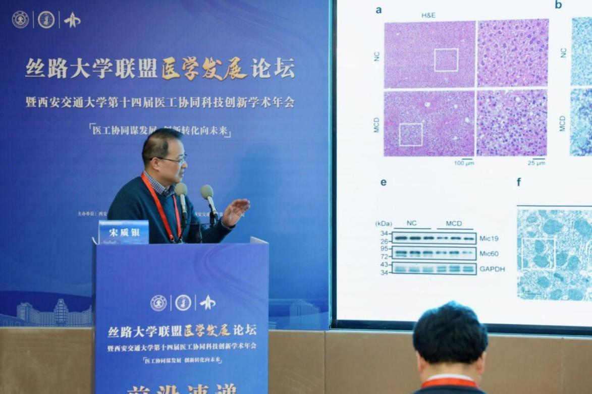 武漢大學生命科學學院宋質銀教授以《線粒體嵴動態調控與疾病》為題