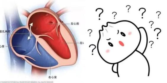 TCD怎么切换探头小探头 大作用——脑部的听诊器_https://www.jmylbn.com_新闻资讯_第6张