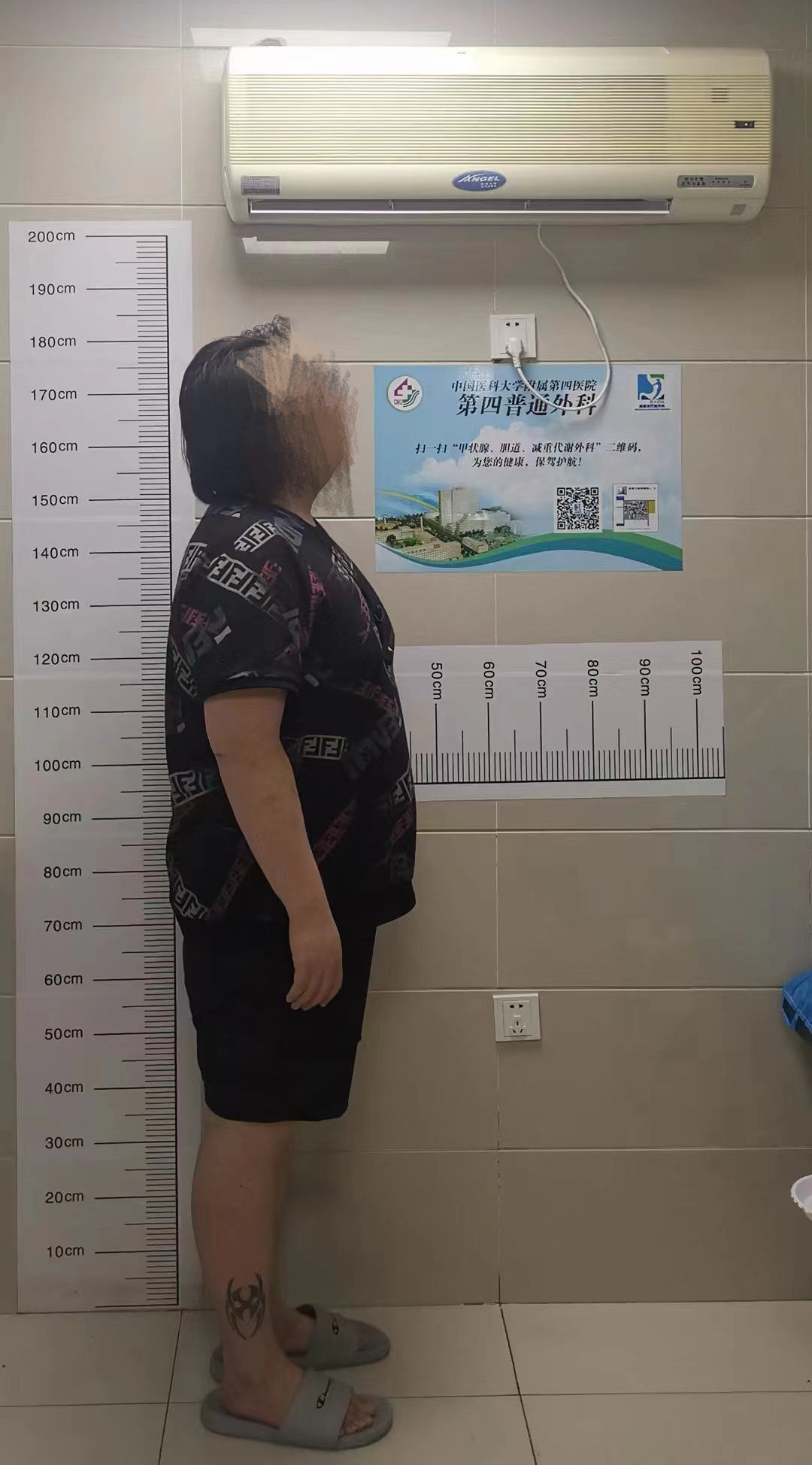 宇轩(化名)接受减重手术前