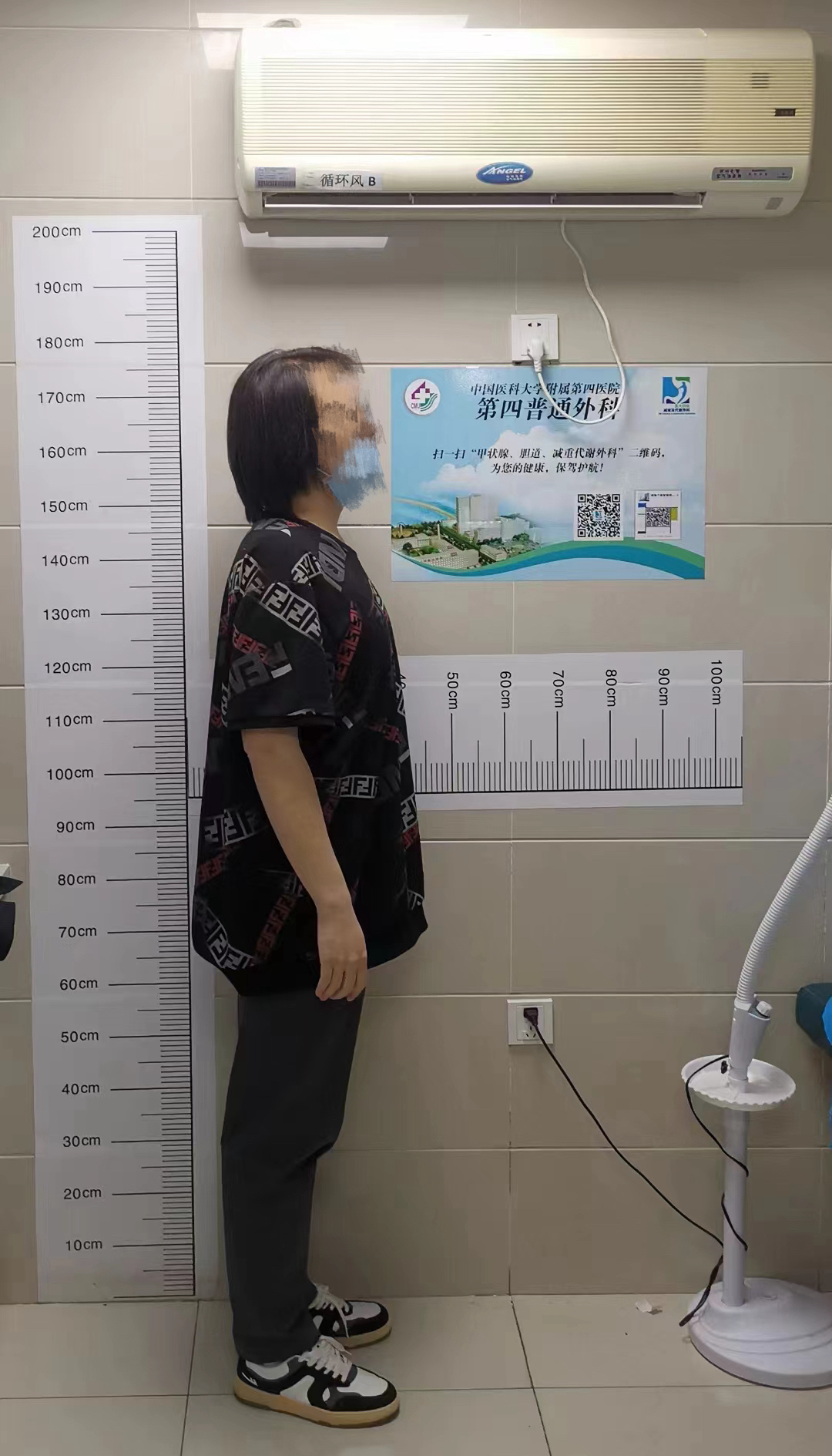 宇轩(化名) 于中国医科大学附属第四医院接受减重手术一年后进行复查