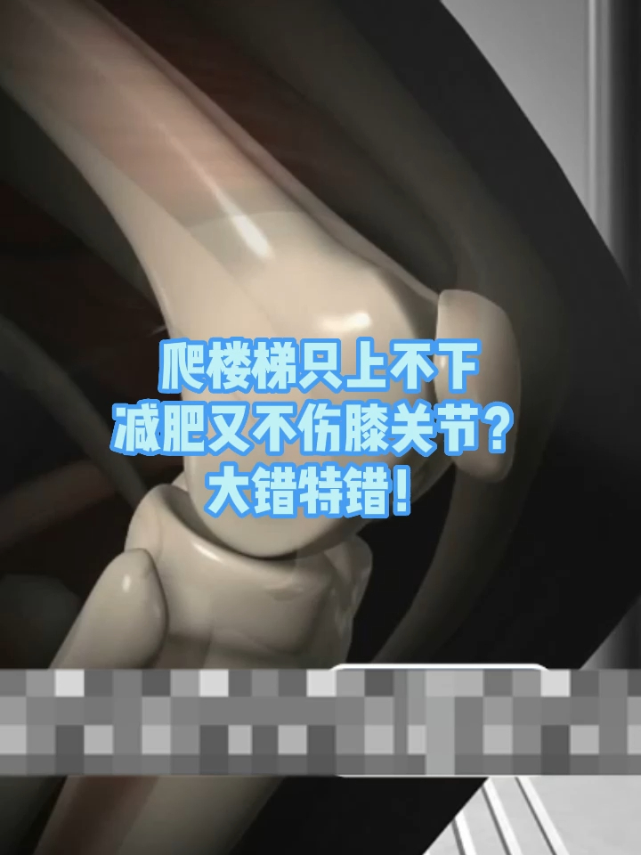 节后减肥别用错方法爬楼梯减肥有这种风险爬楼梯只上不下减肥又不伤膝