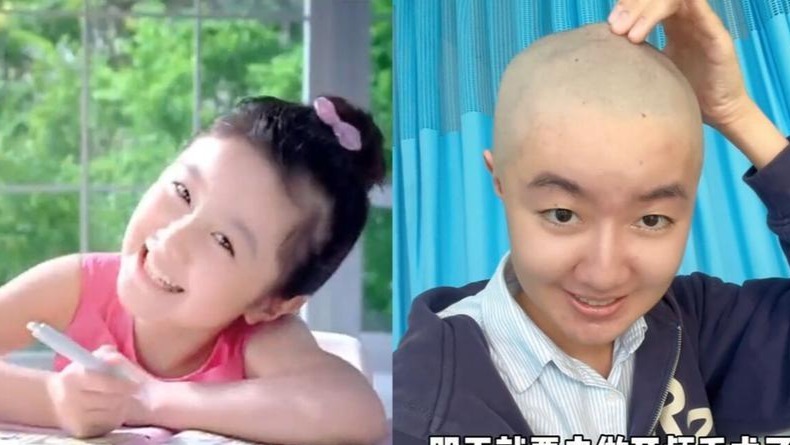 “点读机女孩”自曝患罕见脑瘤，记录剃光头发过程，曾称为保研熬夜伤了身体