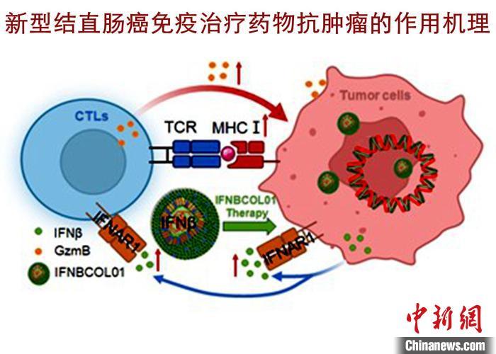 中新健康天津大学针对结直肠癌免疫治疗取得新突破
