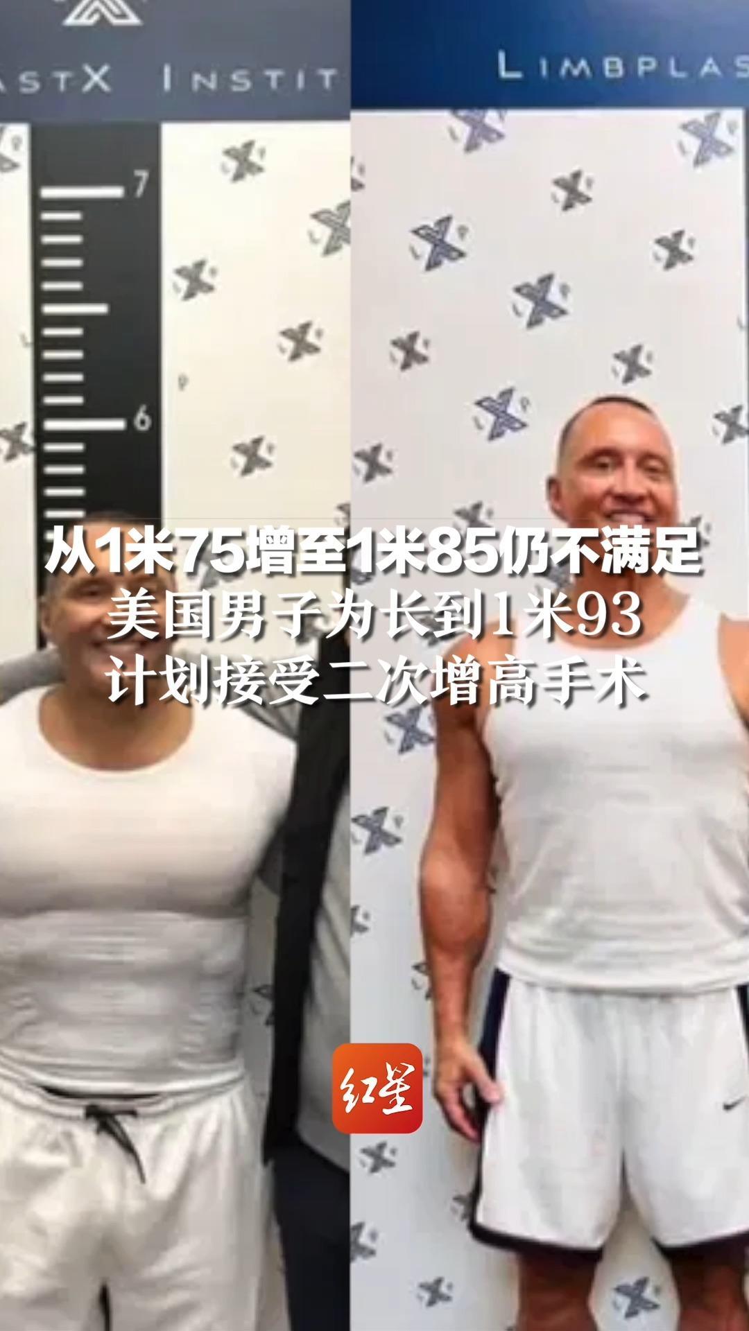 从1米75增至1米85仍不满足,美国男子为长到1米93,计划接受二次增高