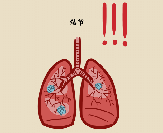 别被陈桂林吐黑水带偏了肺结节肺囊肿会成肺癌吗