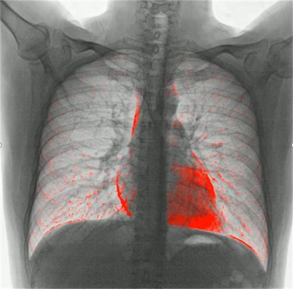 DR影像怎么重新上传动态DR技术：革新医学影像，精准诊断新篇章_https://www.jmylbn.com_新闻资讯_第3张