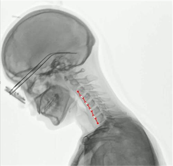 DR影像怎么重新上传动态DR技术：革新医学影像，精准诊断新篇章_https://www.jmylbn.com_新闻资讯_第5张