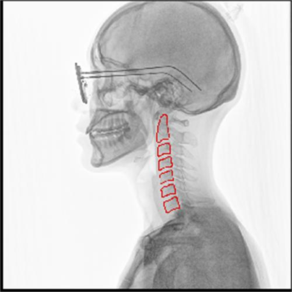DR影像怎么重新上传动态DR技术：革新医学影像，精准诊断新篇章_https://www.jmylbn.com_新闻资讯_第4张