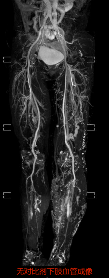 当天开单、当天检查 南山医院磁共振检查已不用预约啦
