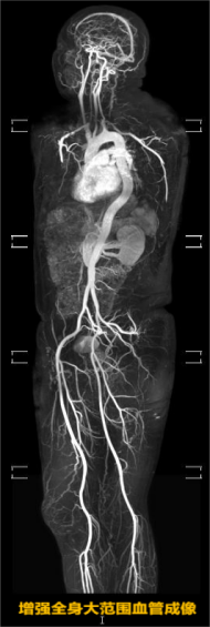 当天开单、当天检查 南山医院磁共振检查已不用预约啦