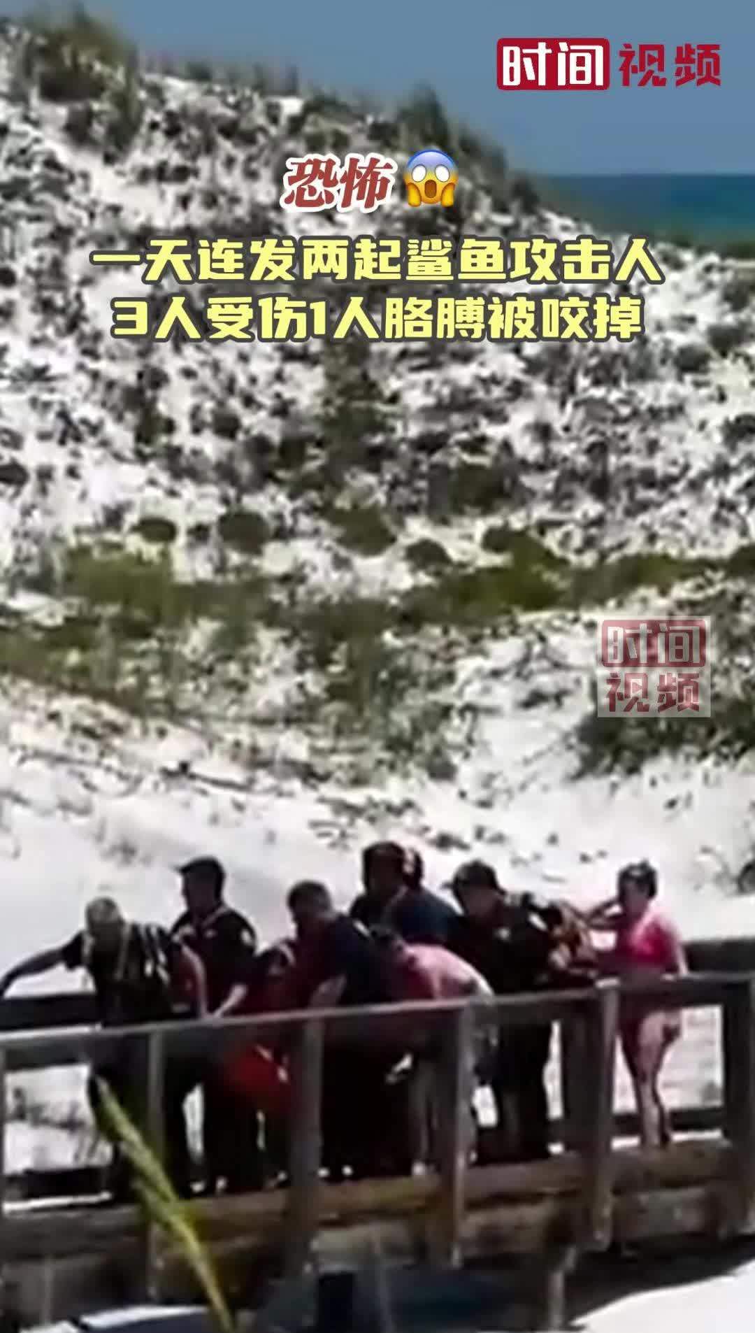 恐怖美国一海滩一天连发两起鲨鱼袭人三人受伤一人胳膊被咬掉