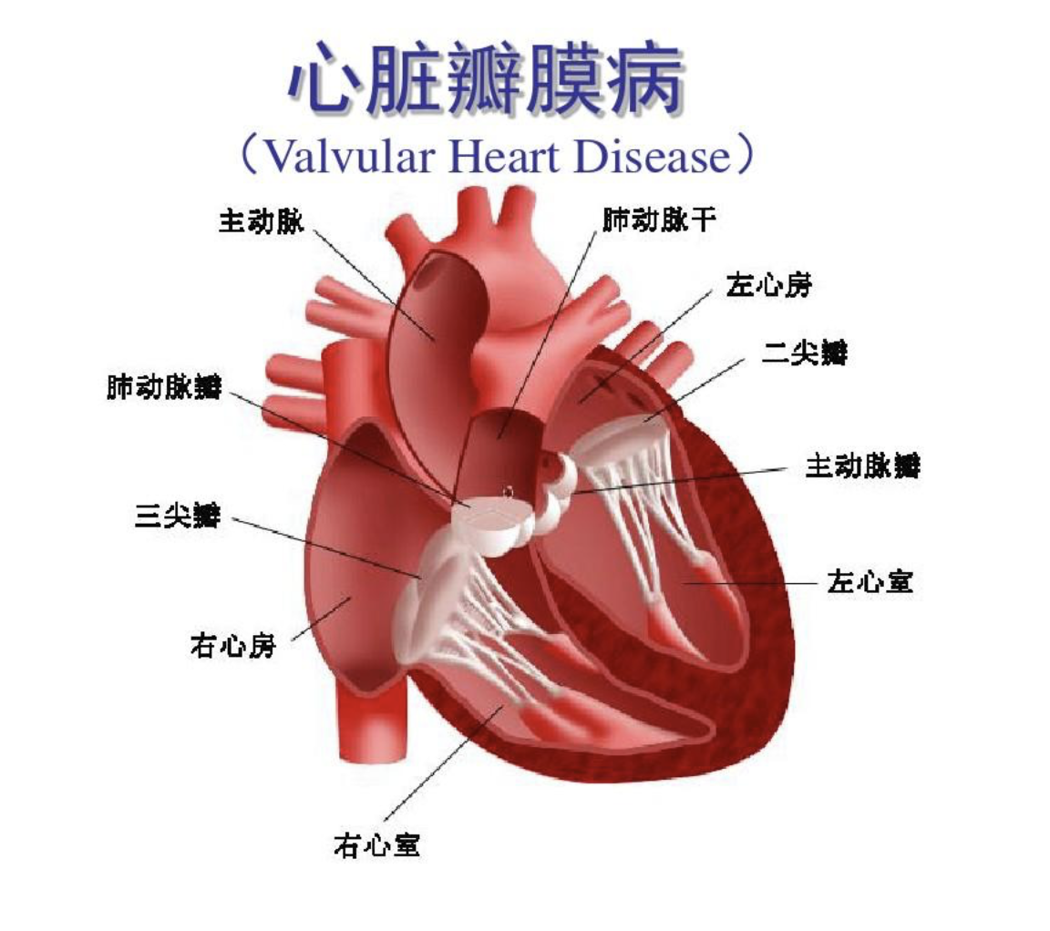 心脏瓣膜示意图图片