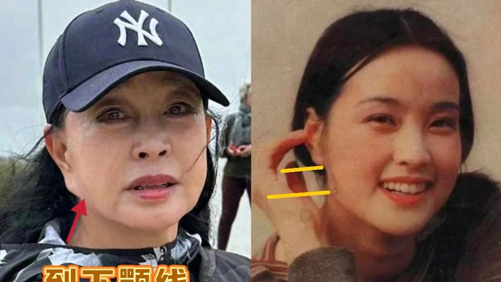 74岁刘晓庆耳垂二次发育，耳垂快耷拉到下巴了