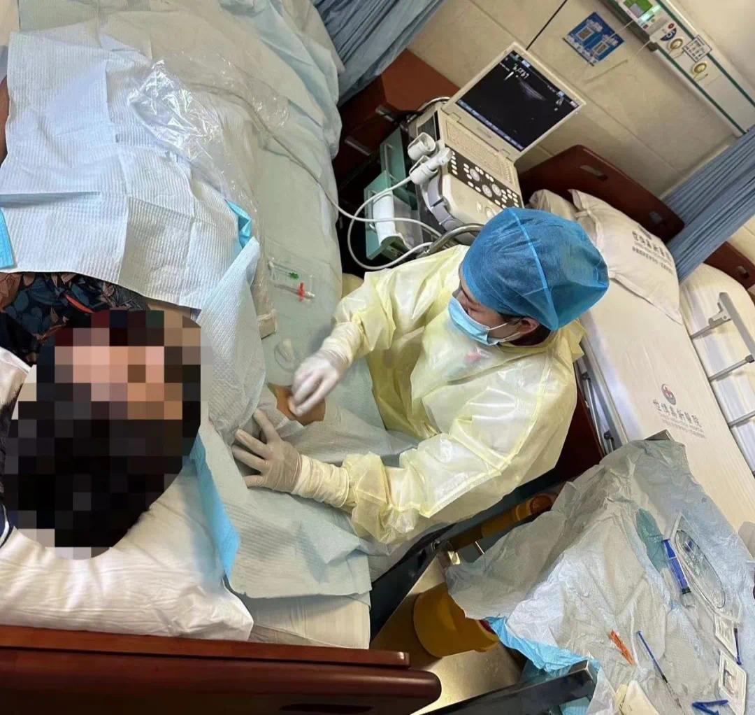 picc导管是什么材质【品质世博】PICC一“管”到底——肿瘤患者的最佳伴侣_https://www.jmylbn.com_新闻资讯_第3张