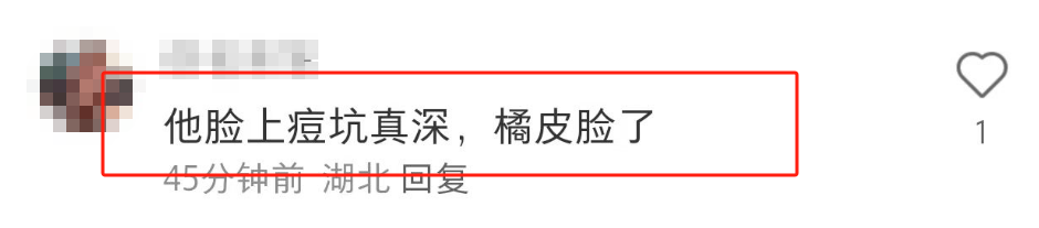 4岁高晓松近照曝光：身形暴瘦、满脸痘印，长发变短发被嘲像大妈"