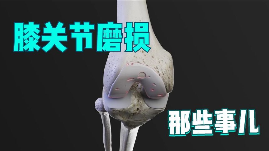 膝盖为啥总疼？三维动画带你看看膝关节磨损的那些事儿