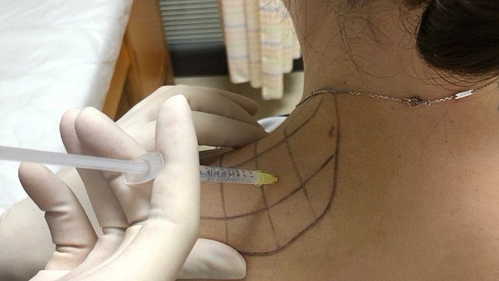 姐妹俩注射瘦肩针相继中毒，医生：肉毒素是神经毒素，可致死