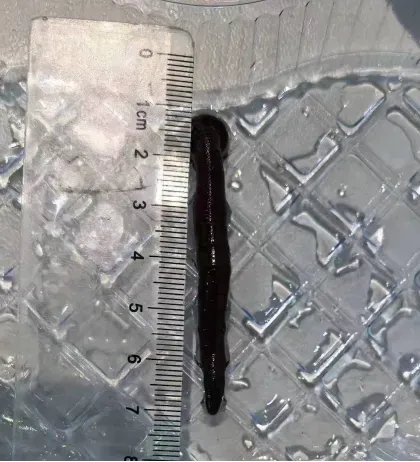 （取出的蚂蟥长达6cm）