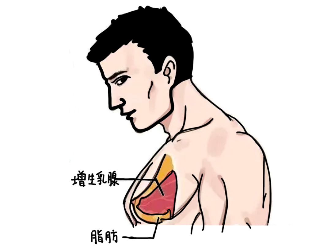 男性乳腺结构图片