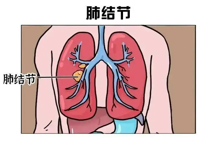 点击查看原始图片