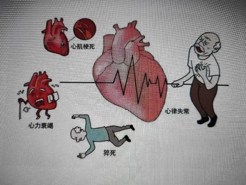se怎么开心电图做心电图检查时需要注意什么？_https://www.jmylbn.com_新闻资讯_第3张