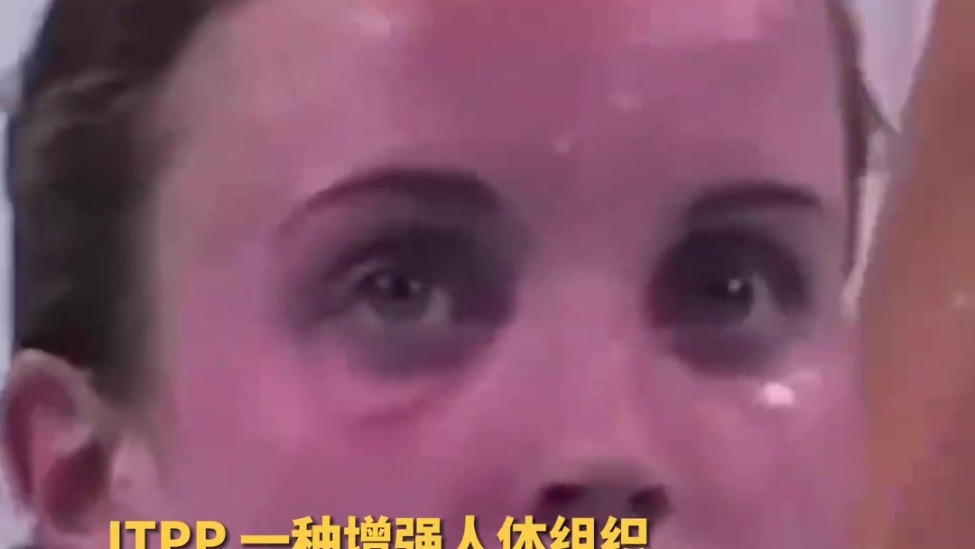 知名网红健身教练分析美国游泳队“紫薯脸” 可能使用一种叫TPP的禁药