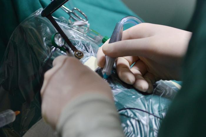 陶勇曾经灵巧的双手 受访者供图