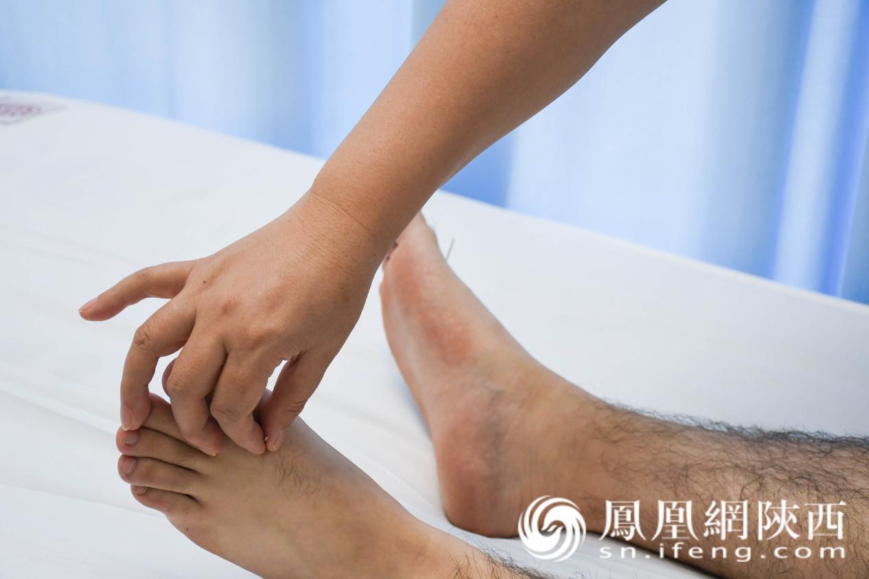 宋艳敏主任为患者针灸