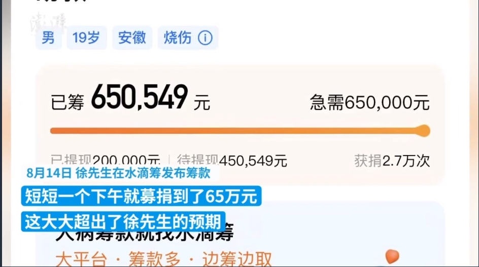 安徽一19岁男生全身87%烧伤 已被江西警察学院录取