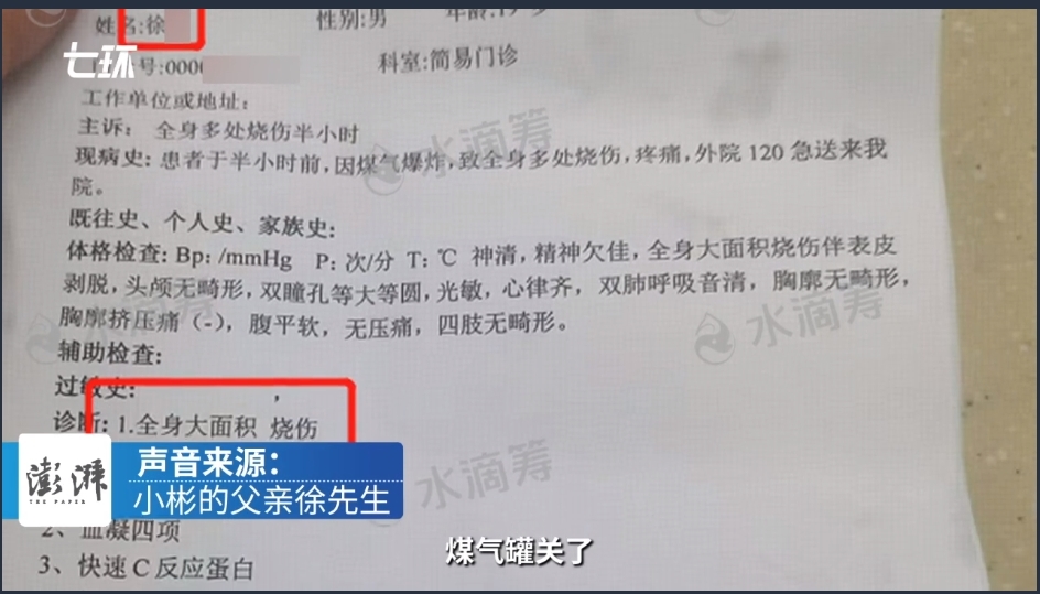安徽一19岁男生全身87%烧伤 已被江西警察学院录取