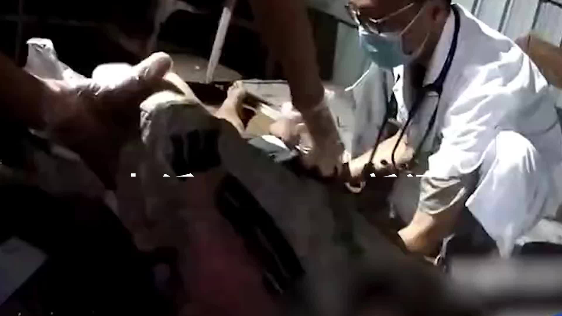 女孩海边打电话不慎被雷击致心脏骤停，警民轮流进行心肺复苏
