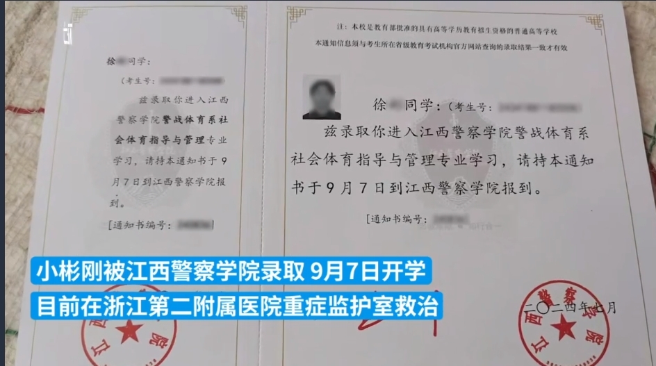 安徽一19岁男生全身87%烧伤 已被江西警察学院录取