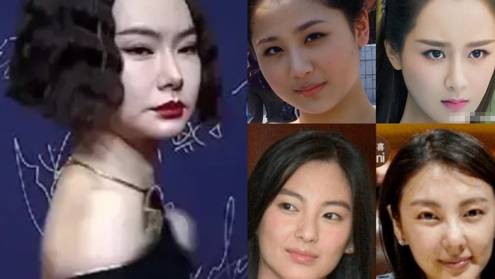 这还叫没整？杨紫僵硬笑不出，谢依霖鼻子移位，戚薇大变样封面图