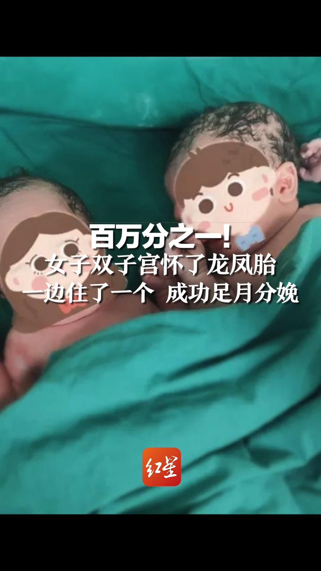 百万分之一！女子双子宫怀了龙凤胎，一边住了一个 成功足月分娩