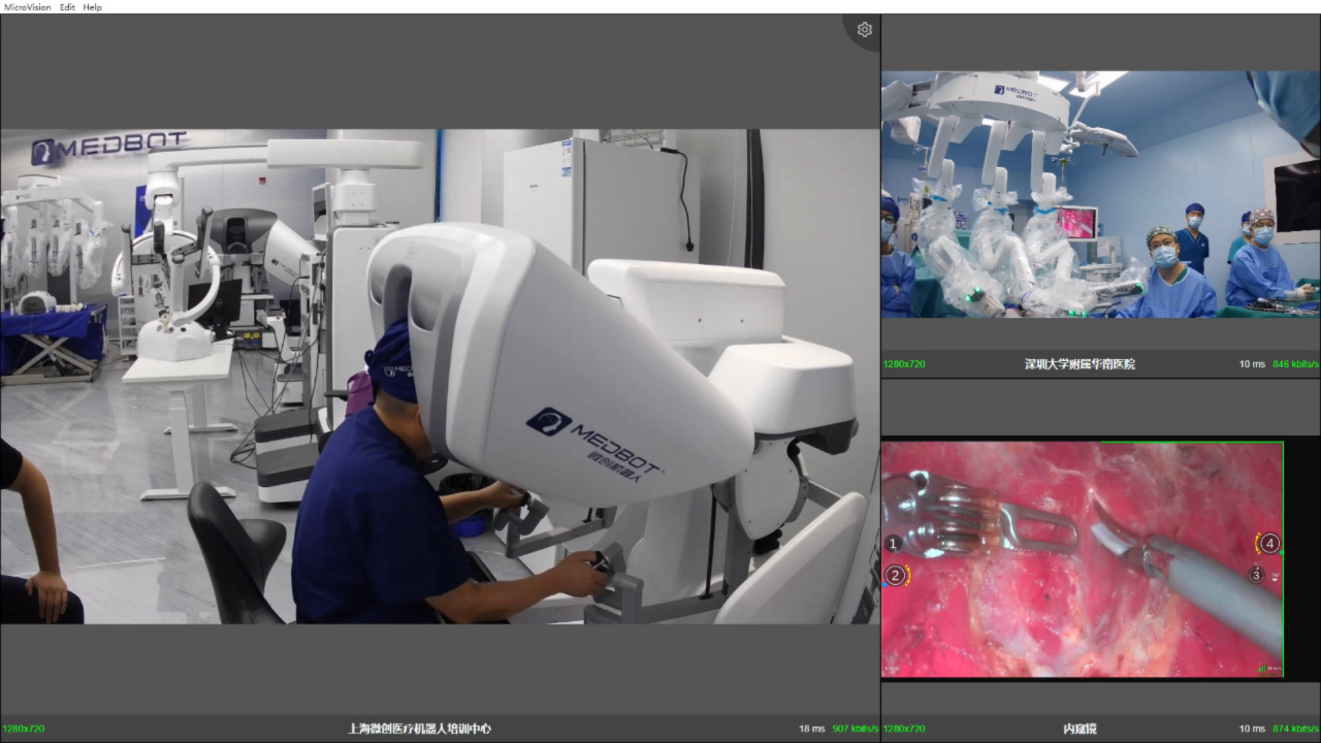 跨越1300多公里! 国内首例5G远程国产手术机器人 甲状腺癌手术顺利开展