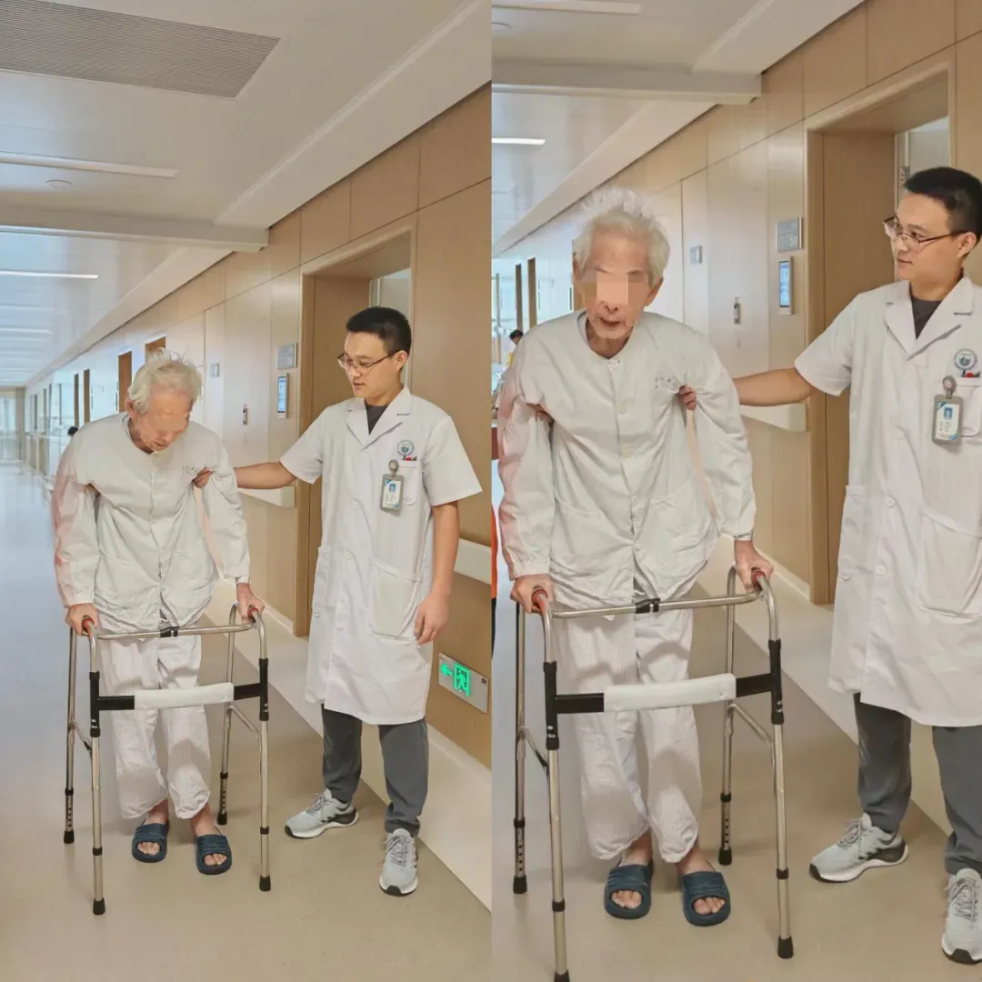 ▲术后早期下床行走