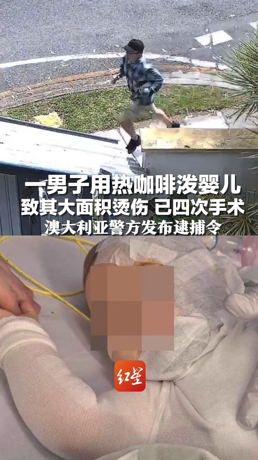 一男子用热咖啡泼婴儿致其大面积烫伤，已接受4次手术 澳大利亚警方发布逮捕令