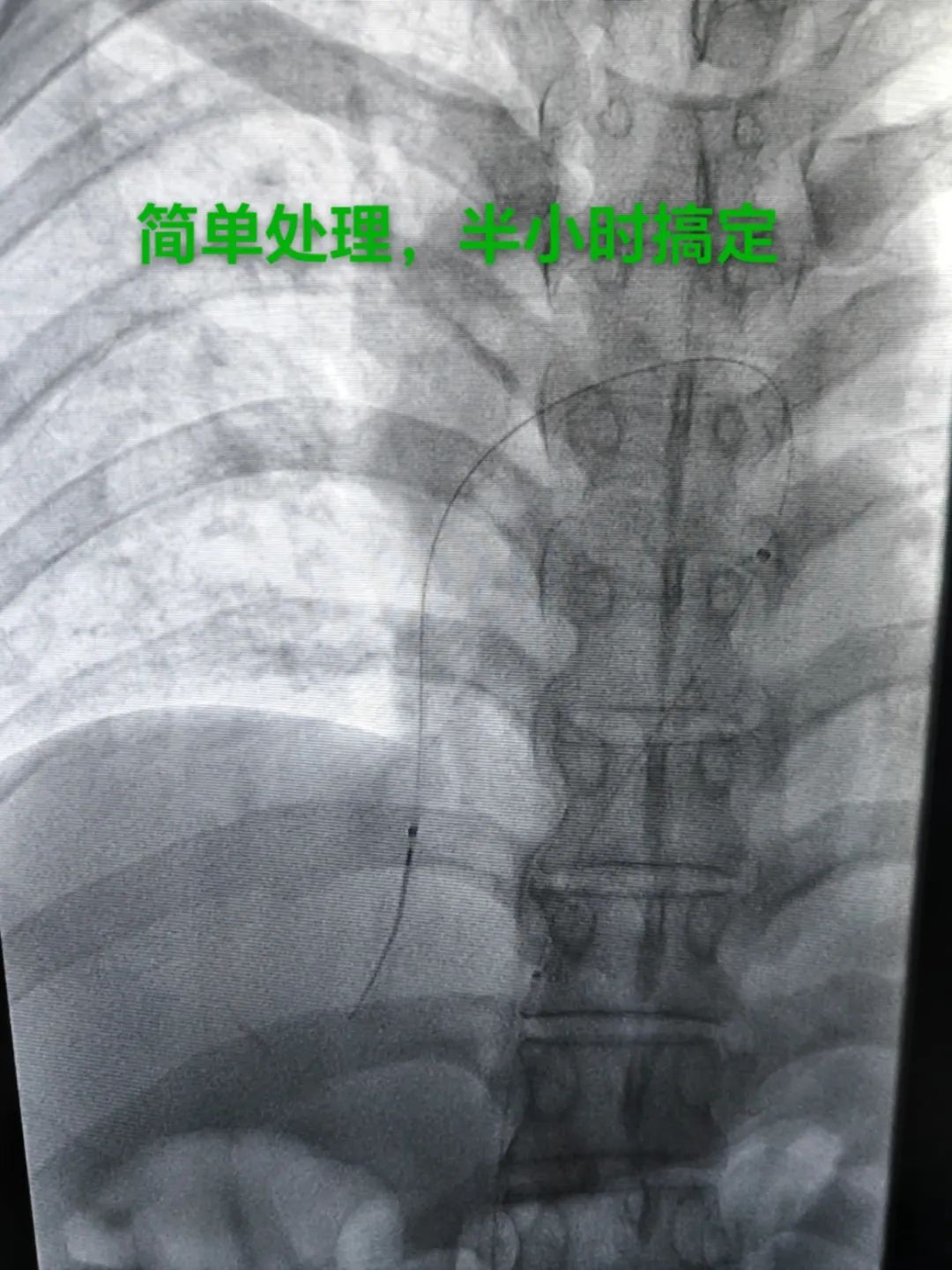 国庆我在岗 西海岸新区中心医院：忙碌的“卡点”，坚实的“医靠”