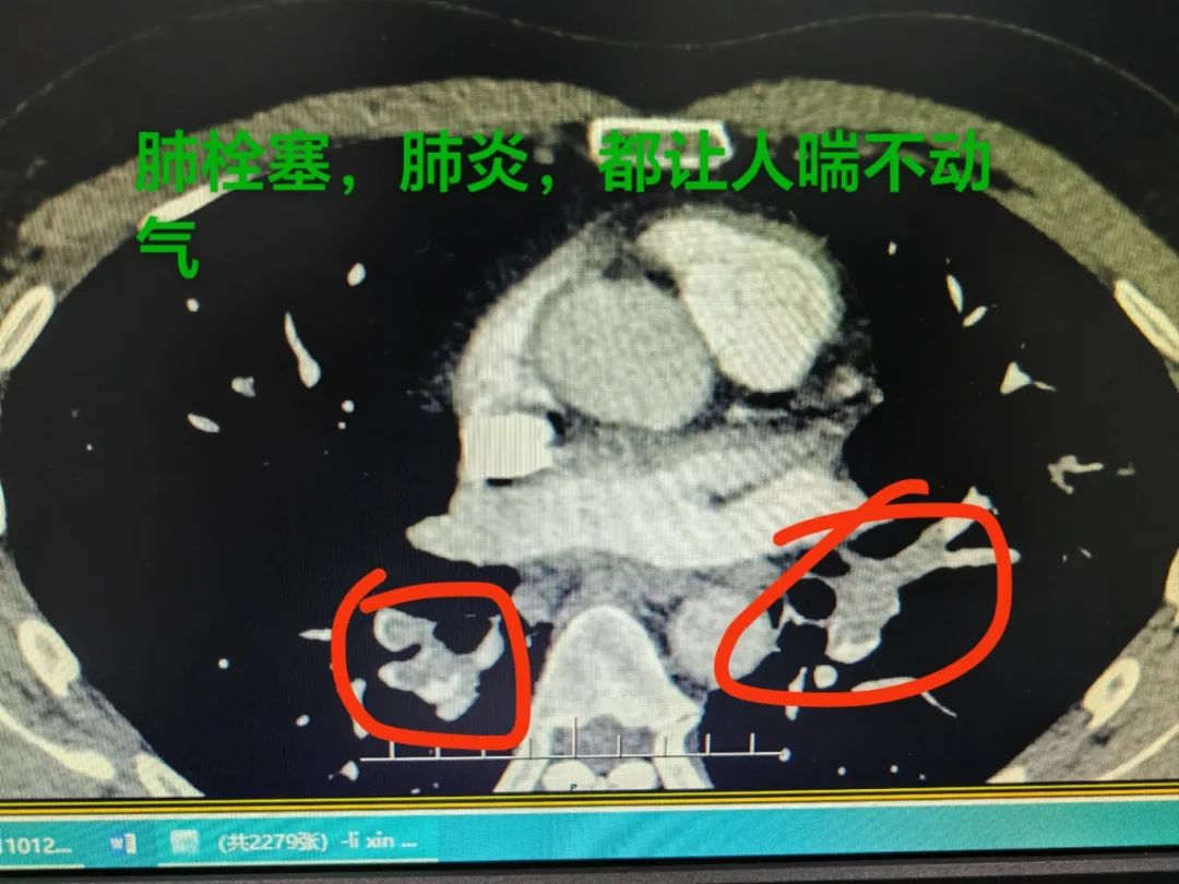 国庆我在岗 西海岸新区中心医院：忙碌的“卡点”，坚实的“医靠”