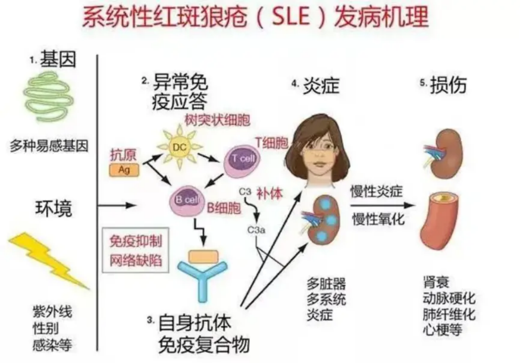 上海姑娘患红斑狼疮在瑞士安乐死，这种“不死癌症”晒太阳也会得？