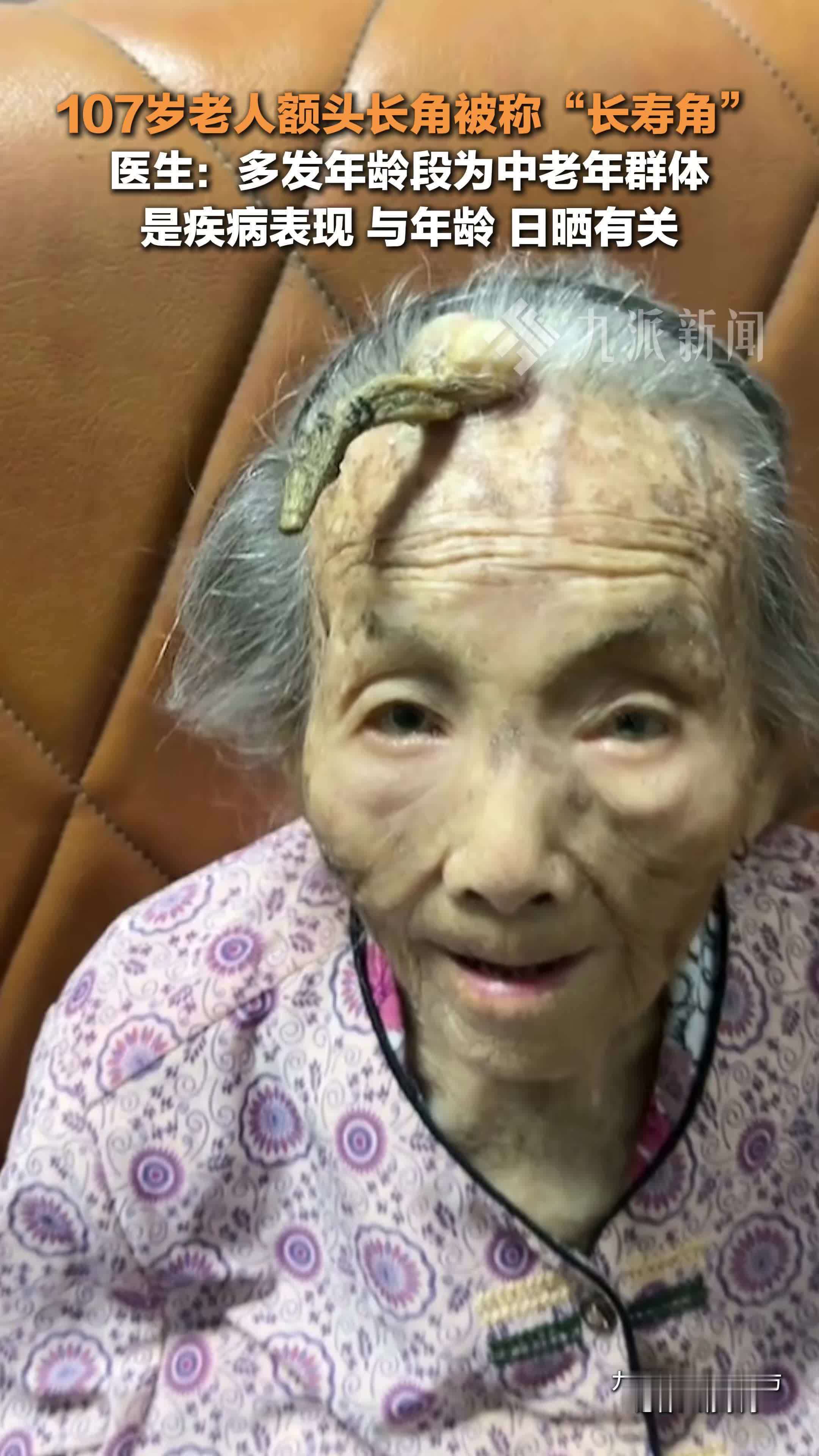 医生回应107岁老人额头长角