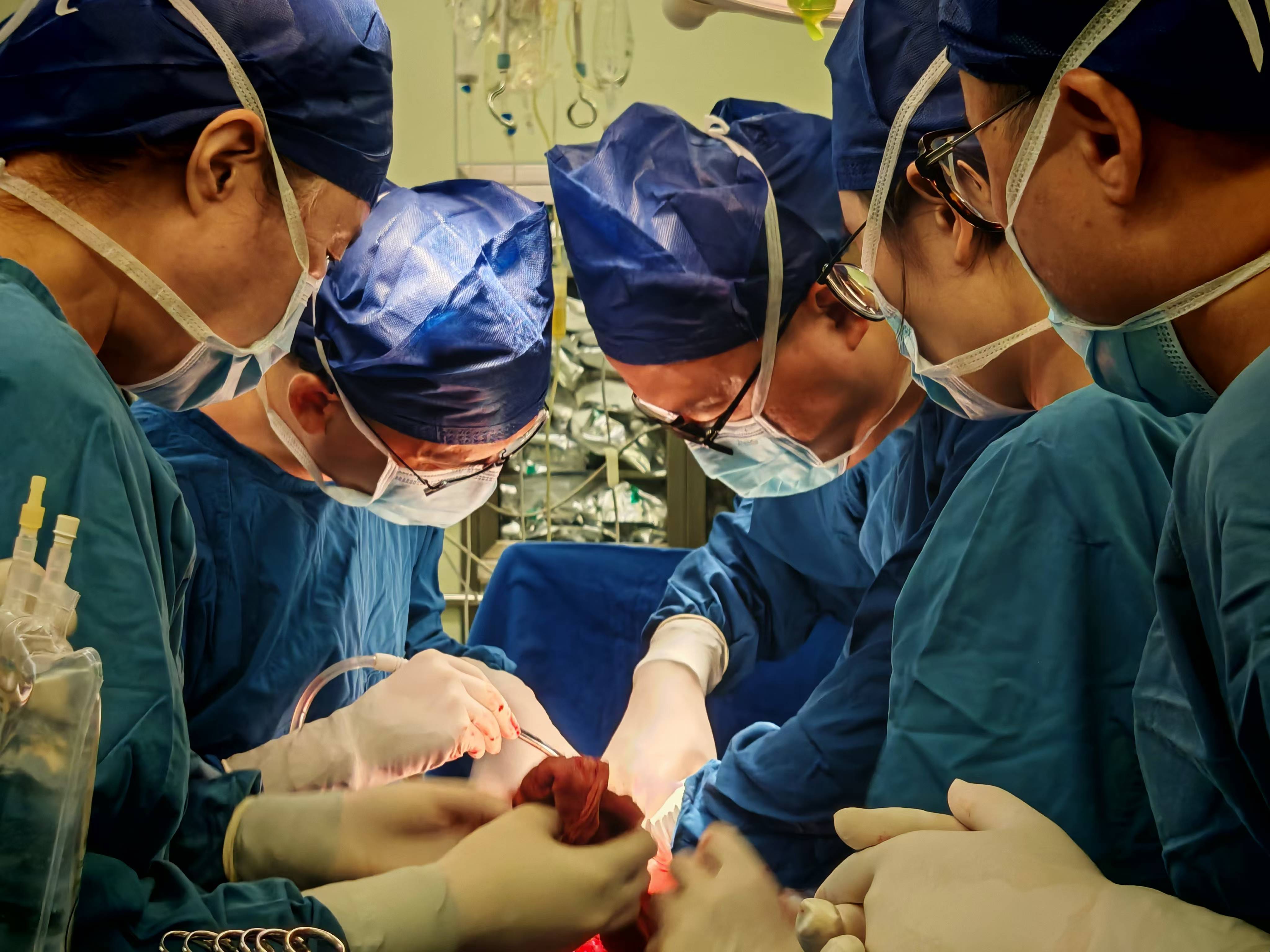 10月14日 中大医院泌尿外科、妇产科、普外科及麻醉手术与疼痛管理科等多学科合力成功“拆弹”