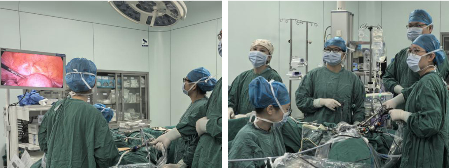 常德一医妇科专家实施腹腔镜子宫手术