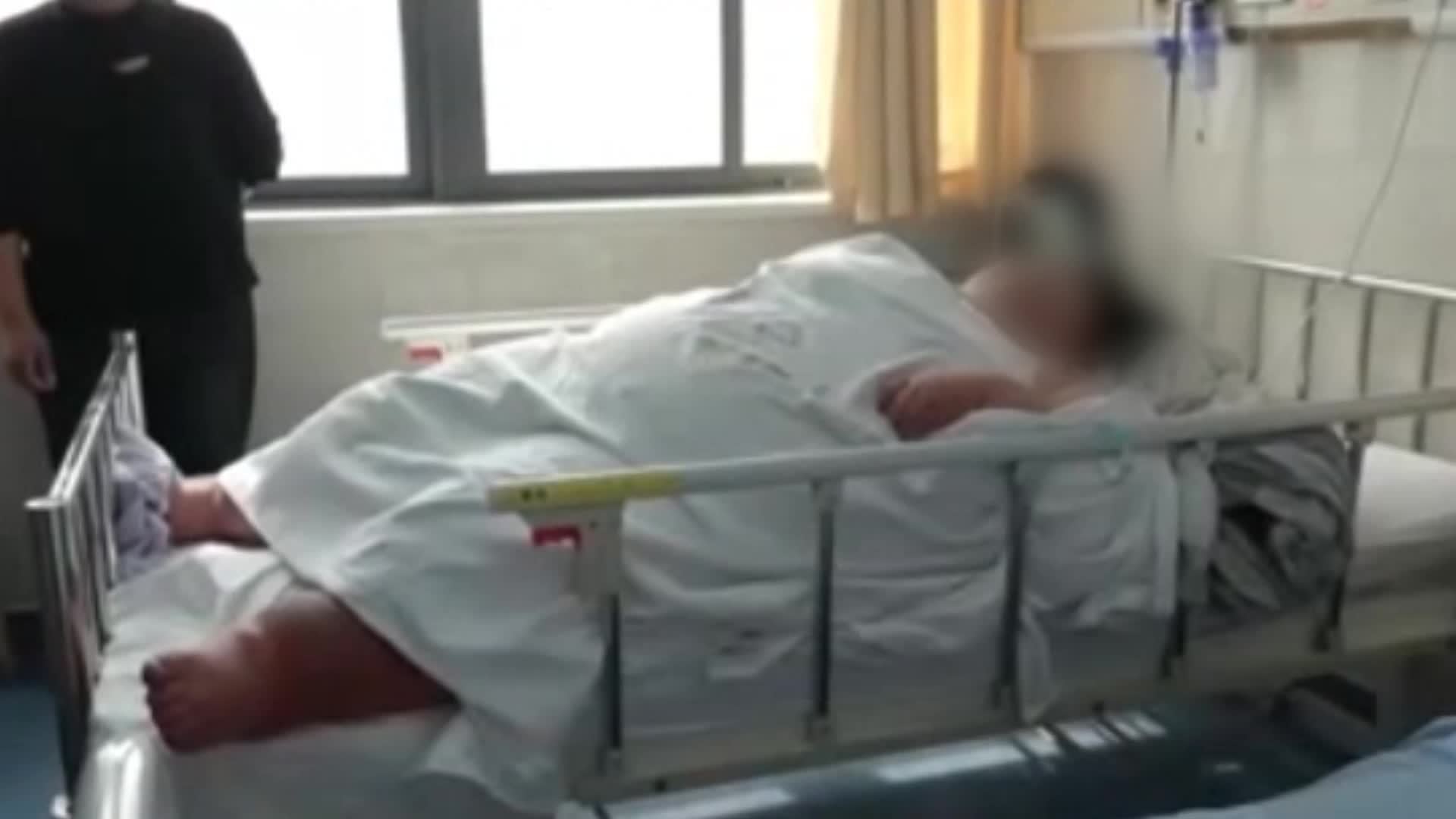 超超级肥胖！12岁女孩体重达400斤，家属：她的食量和其他同龄小孩无较大差异