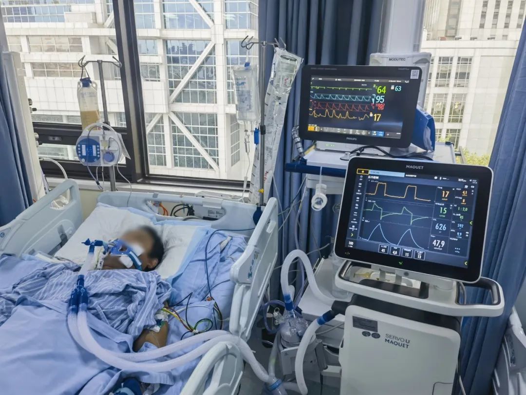 齐鲁细胞合作的人脐带间充质干细胞来源外泌体（hUCMSCs-Exos）治疗ARDS项目完成首例受试者入组