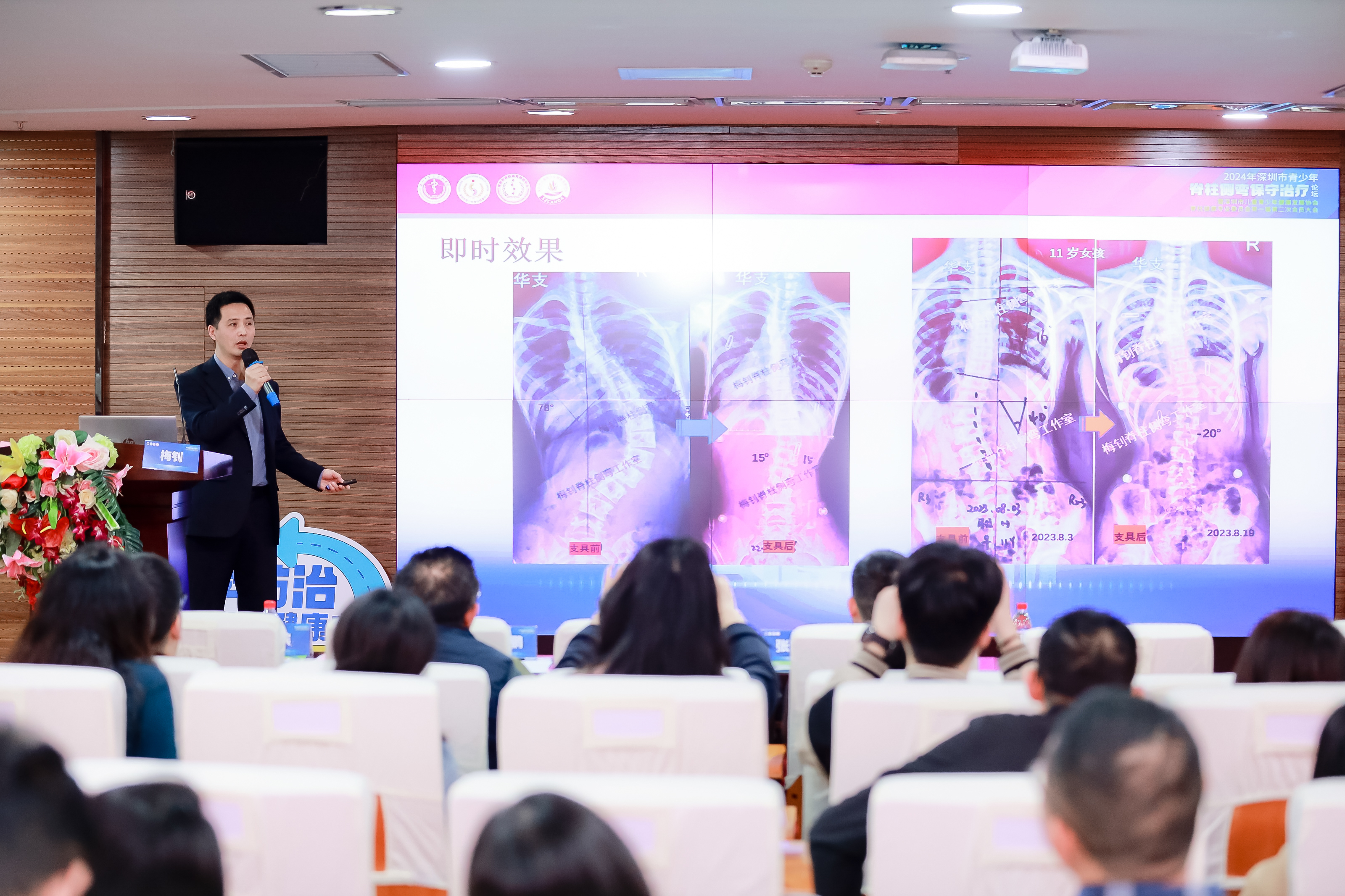 汇聚专家智慧，探索脊柱侧弯保守治疗新篇章