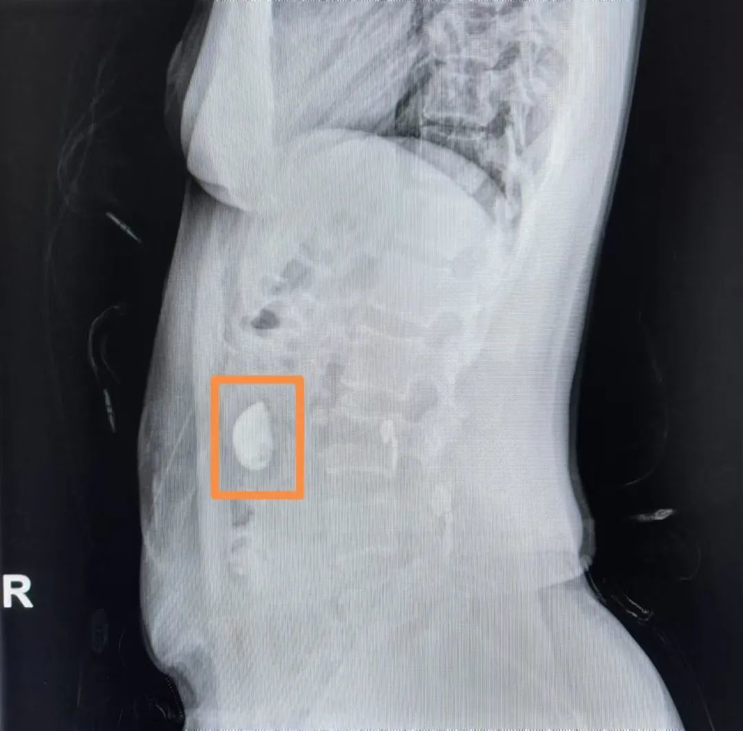 （腹部立位片：异物为图中圈出位置所示 ）