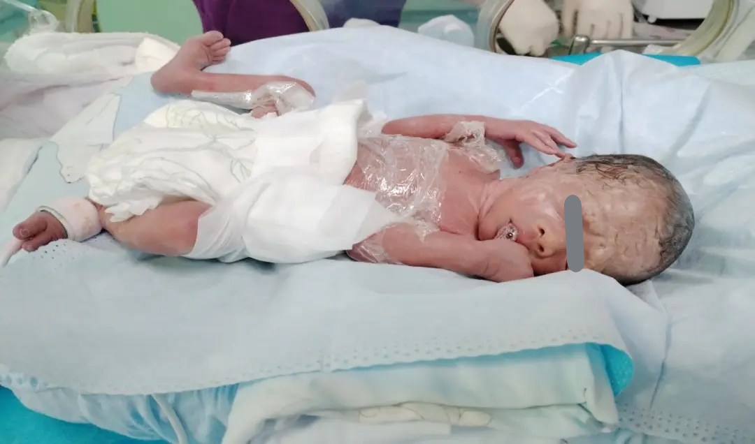 ▲刚出生的宝宝比巴掌大一点点