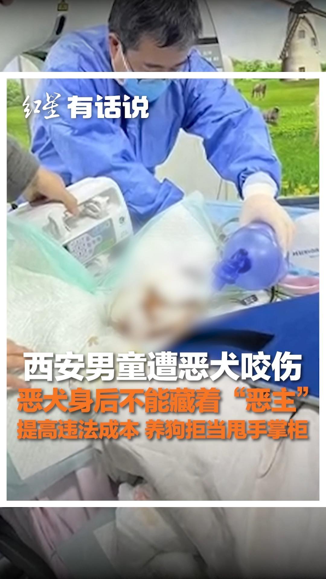 西安男童遭恶犬咬伤 恶犬身后不能藏着“恶主”提高违法成本，养狗拒当甩手掌柜