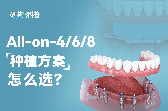 硬核科普：All-on-4/6/8，种植方案怎么选？